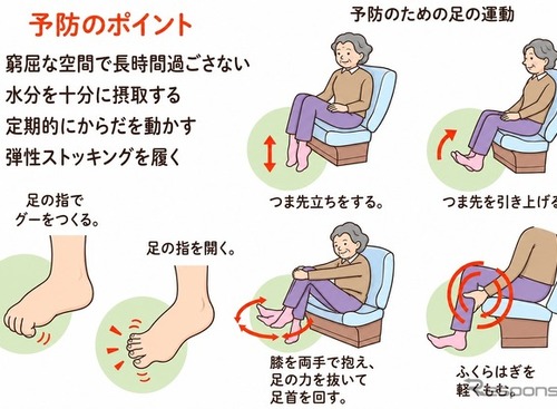 ＜注意喚起＞車中泊のエコノミークラス症候群、日本赤十字社が対策を紹介…熊本地震 画像