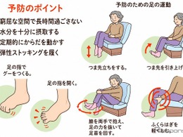 ＜注意喚起＞車中泊のエコノミークラス症候群、日本赤十字社が対策を紹介…熊本地震