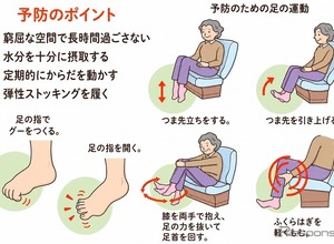 ＜注意喚起＞車中泊のエコノミークラス症候群、日本赤十字社が対策を紹介…熊本地震 画像