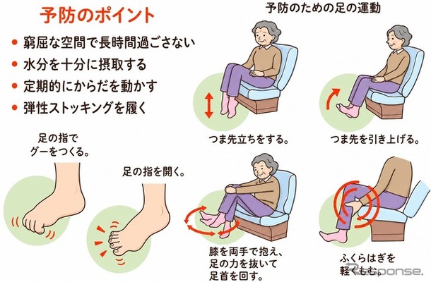 エコノミークラス症候群予防のポイント